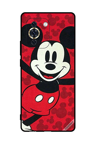 Covernex غطاء حماية لهاتف هواوي نوفا 10 - ميكي ماوس سعيد