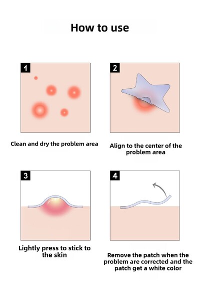 OOTD شريط ستار سبوت باتش 5 ألوان