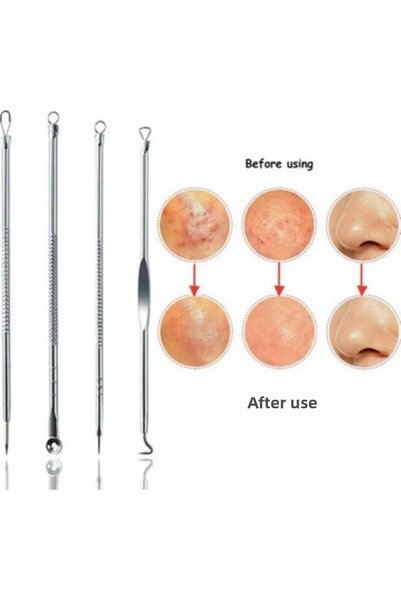 Generic Brand Stainless Acne-Blackhead Cleaner Skin Apparatus Comedone Removal Set