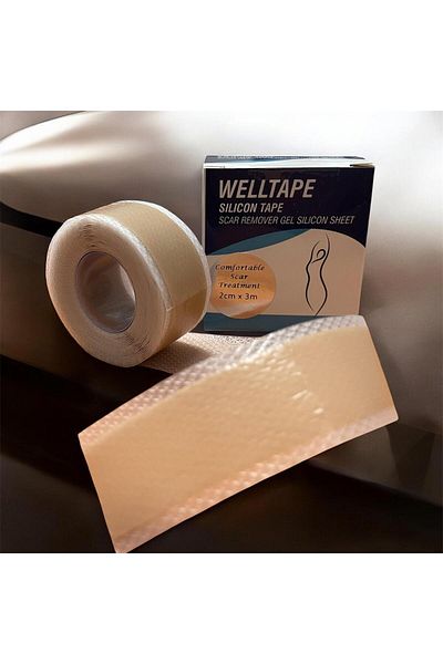 WELLTAPE Silicone Gel Scar Removal Tape Lesion Scar Keloid Skin Stretch Marks Surgery Scar Remover 2cm X 3m