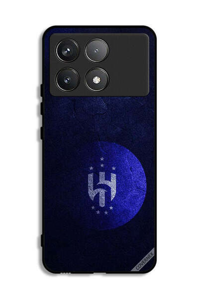 Covernex غطاء حماية شاومي ريدمي كيه 70 برو - نادي الهلال السعودي