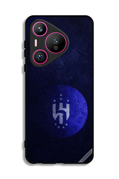 Covernex غطاء حماية هواوي بيورا 70 لنادي الهلال السعودي