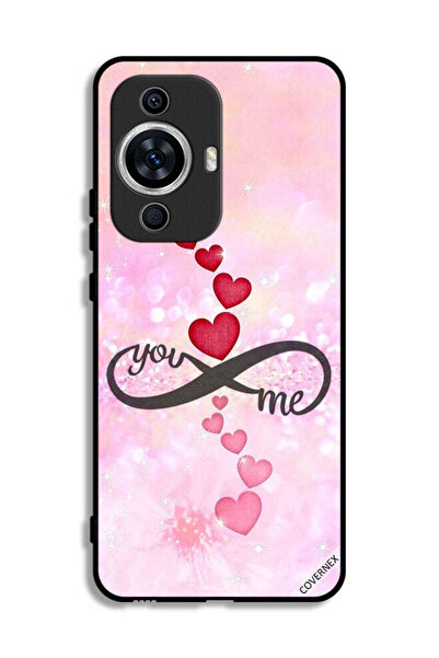 Covernex Huawei nova 11 Protective Case Cover You And Me