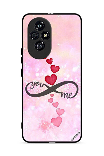 Covernex غطاء حماية لهاتف Honor 200 5G بتصميم "أنت وأنا"