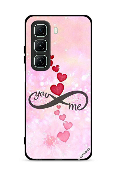Covernex غطاء حماية لهاتف Infinix Hot 50 5G بتصميم "أنت وأنا"