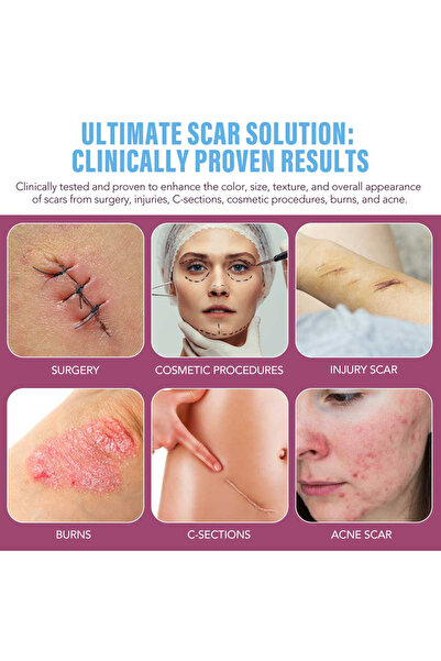 vogsign Gel de silicon pentru repararea cicatricilor, îngrijire intensivă 24 de ore, formulă premium avansată, 30 g