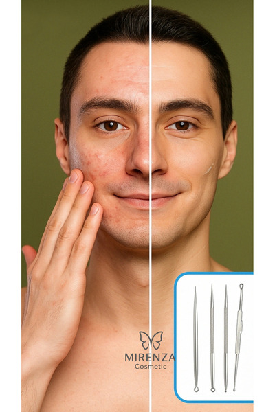 mirenza cosmetic Siyah Nokta ve Temizleyici 4'lü Komedon Seti Paslanmaz Çelik...