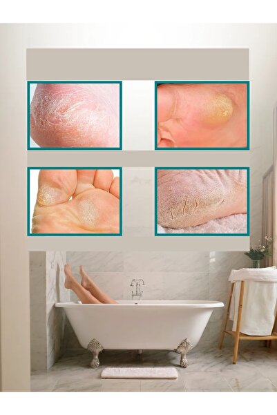 Transformacion Çelik Topuk Törpüsü - 10 Yedekli Profesyonel Çelik Topuk Törpüsü Solingen Professional 721909