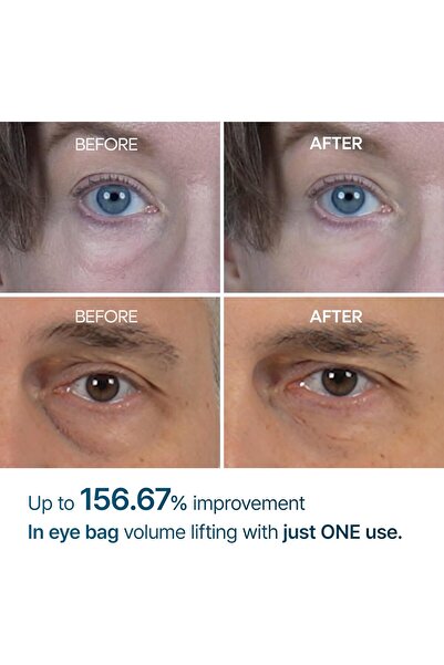 Dr.Melaxin Dr. Melaxine Eye Cream for Reducing Puffiness, Dark Circles, and Wrinkles, 0.33 fl oz