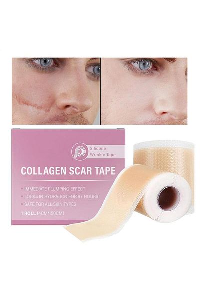 Choice as shows Silicone Scar Removal Strips 4x150cm/roll Scar Tape Keloid Removal Strip Sheets Tape Self-A