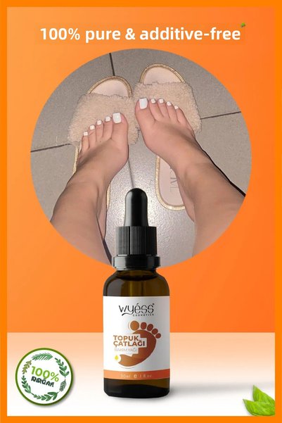 Wyess New Effective Formula Foot and Heel Crack Care Oil Premium A-Quality 30 ml
