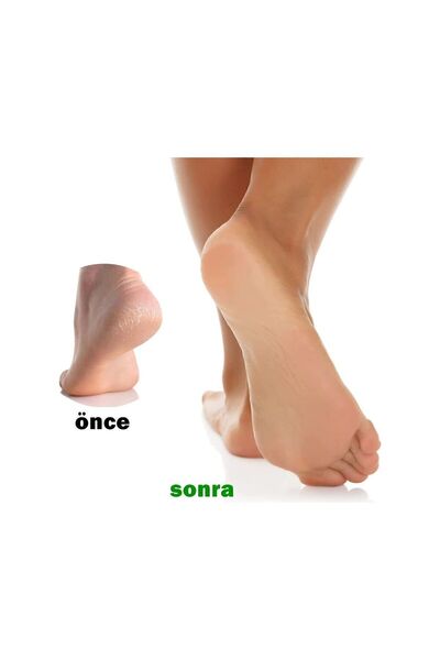 Transformacion Peeling Topuk Törpüsü 2 Taraflı 720646