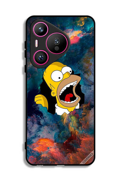 Covernex غطاء حماية لهاتف هواوي بيورا 70 سيمبسون