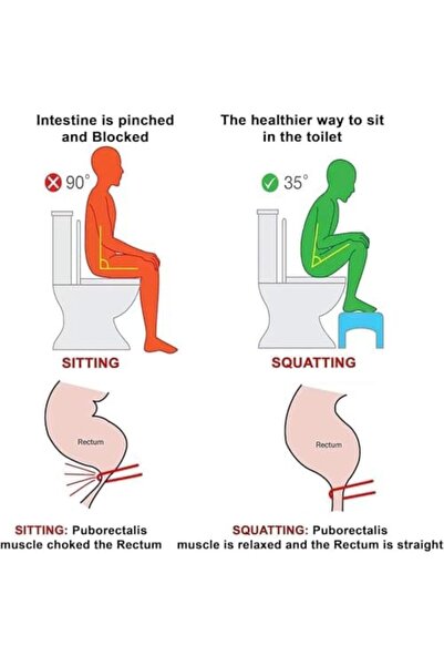 mastergold Durable and lightweight plastic toilet footrest 41x47x17 cm helps maintain a comfortable and healthy squatting position
