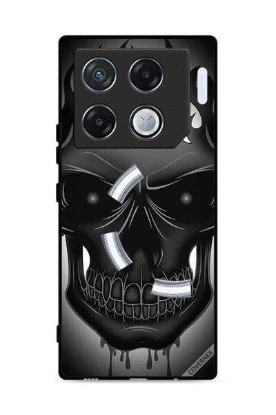 Covernex غطاء حماية لهاتف Infinix GT 20 Pro 5G برسومات جمجمة