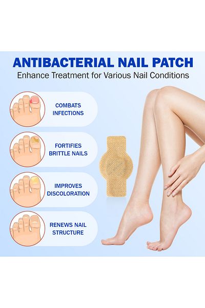 Choice 21Pcs Waterproof Toenail Fungus Patch Nail Repair Patches Ingrown Correction Sticker for Discolor...