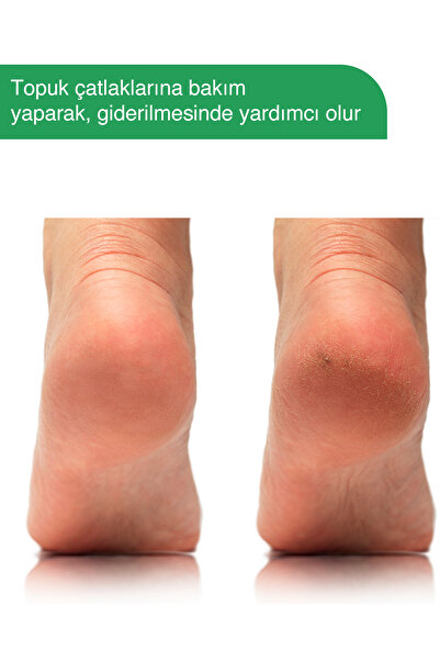 BİOVELLA Ayak Kokusu Giderici Nemlendirici Çay Ağacı Ve Doğal Özlü Köpüklü Ayak Bakım Şampuanı 100ml