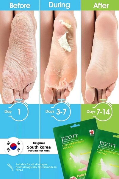 Jigott Sock Type Peeling Foot Peeling Mask - Miracle Foot Peeling Pack