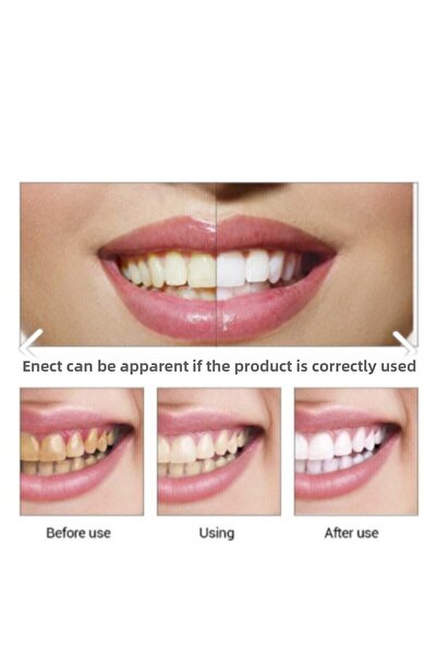 LOVYCO Lanbena Teeth Whitener Set - Effective Whitening