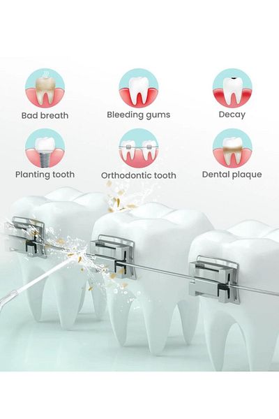 Nicefeel Cordless Dental Water Flosser with IPX7 Waterproof - 100ML Portable Oral Irrigator for Teeth and Gum