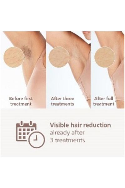 Philips Lumea 7000 Series,ipl Hair Removal,smart Sensor,clinically Performance1 Attachment,bri930/02