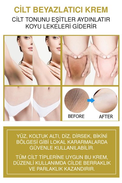 KEATY Farewell Set to Skin Blemishes |   Anti-Blemish Serum with Collagen 30ml + Whitening Cream 50ml