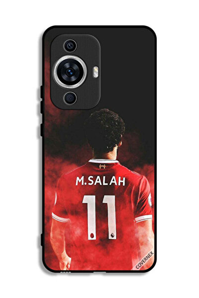 Covernex غطاء حماية لهاتف هواوي نوفا 11 - نجمة مصرية