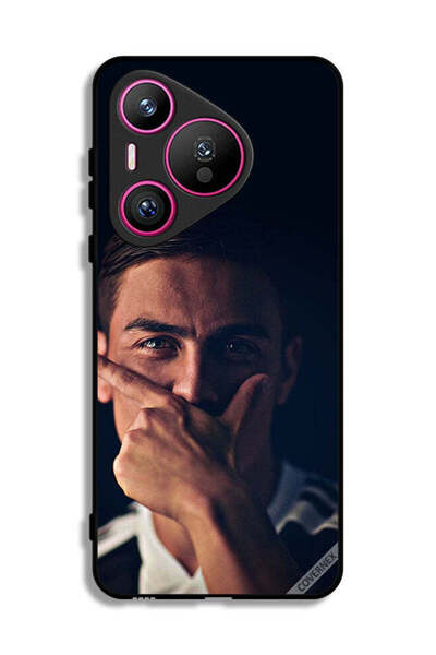 Covernex غطاء حماية لهاتف هواوي بيورا 70 من باولو دي جي