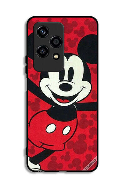 Covernex غطاء حماية لهاتف Honor 200 Lite 5G ميكي ماوس سعيد