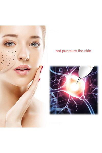 Choice 50pcs 50/100pcs Surgical Sterile Needle Mini Mole Removal Pen Needles For Spot Mole Freckle Plasma P