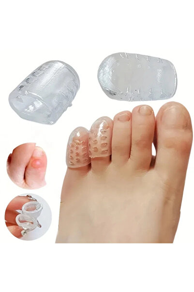 Choice 3 أزواج من غطاء حماية أصابع القدم من السيليكون، غطاء حماية الإبهام، بثور الذرة، أنبوب تخفيف الألم لأصابع القدم، بونيو