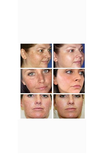 Generic Brand Vip Skin Whitening Cream Set of 3