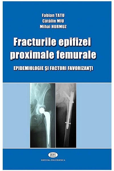 Editura Politehnica Fractures of the proximal femoral epiphysis, Fabian Tat