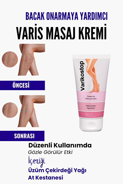 Breeze Var.is Bölgesi Için Bacak Onarmaya Yardımcı Ve Besleyici Varikostop Ma...