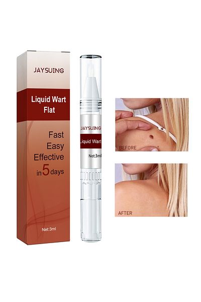 jaysuing Wart Remover Liquid Flat Easy to Use Fast Effective Painless Natural Safe 1 Pcs