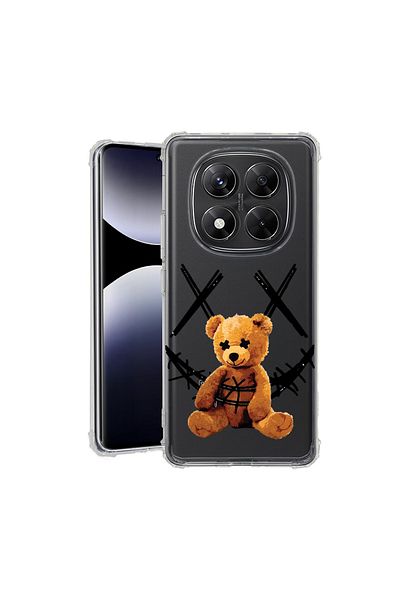bestcase ® Anit Shock Case For Xiaomi Redmi Note 14 Pro 4G, Teddy Bear Smile, 1997764 AS 982