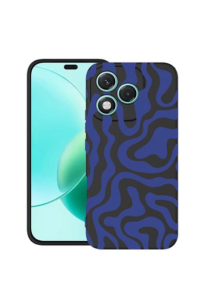 bestcase ® Slim Silicon Case For Honor 400 Lite, Blue Abstract Line, 2022870 B 1477