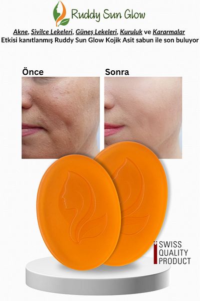 RUDDYSUN Kojic Acid Soap Skin Tone Equalizer Natural Anti Darkening Herbal Face and Skin Bar Kojic Kojiso