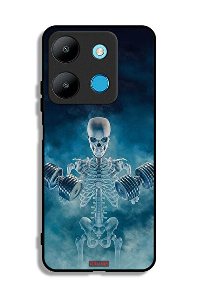 Tolwak غطاء حماية لهاتف إنفينيكس سمارت 7 - وضعية عدم الألم وعدم الكسب