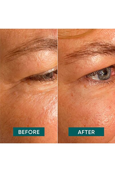 OEM Reusable anti-wrinkle patches with Aloe Vera, after-sun, sensitive skin, 2 pcs for 30 treatments