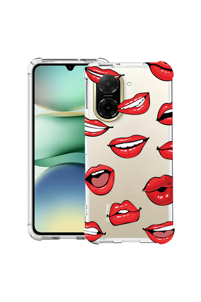 bestcase ® Θήκη Anit Shock για Xiaomi Redmi A5, Χείλη - Μοτίβο Φιλιού, 203099...
