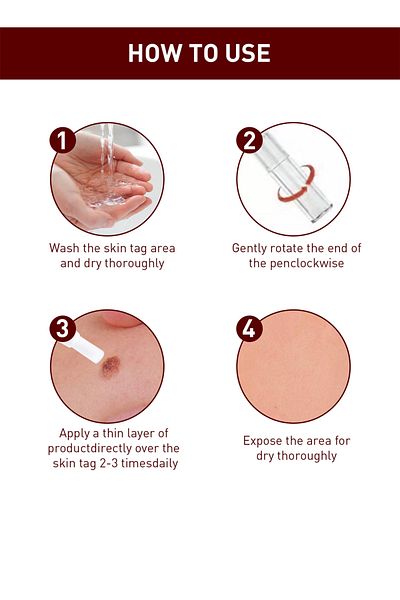jaysuing Wart Remover Liquid Flat Easy to Use Fast Effective Painless Natural Safe 1 Pcs