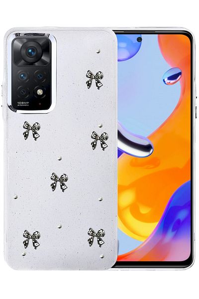 cepmoda Xiaomi Redmi "Note 11 Pro" Case "Black Bow" Pattern Luxury Camera Protruding 3D Cover |   No:10