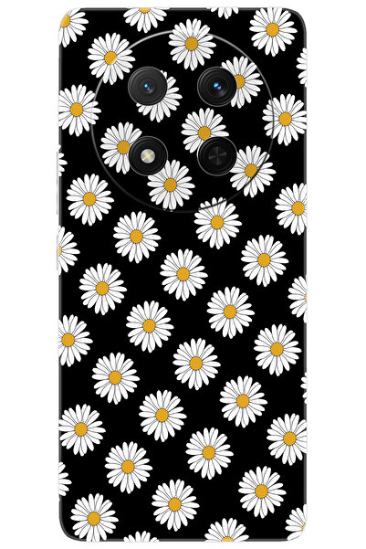 Ceppare Honor Magic 7 Lite (BRP-NX1) Uyumlu Kılıf Desen Baskılı Silikon Papat...