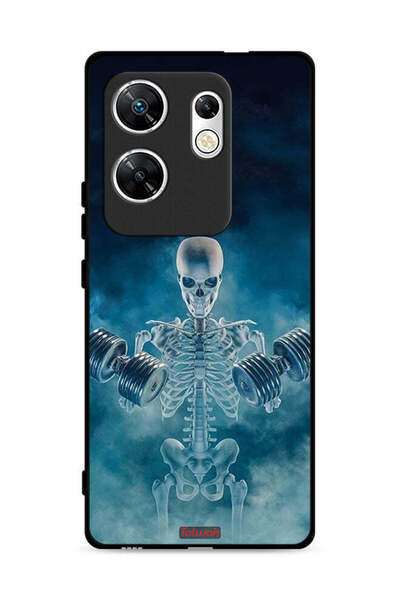 Tolwak غطاء حماية لهاتف Infinix Zero 30 4G، وضعية "لا ألم ولا ربح"