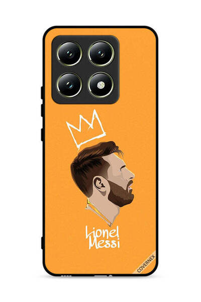 Covernex غطاء حماية لهاتف شاومي 14T 5G ليو ميسي الملك