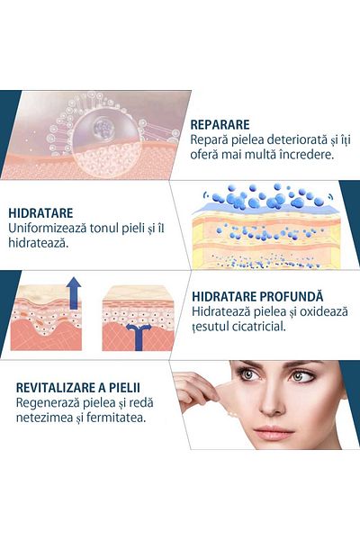 NOVA KISS Rolă premium reutilizabilă din silicon medical pentru tratarea cicatricilor, NOVA KISS®, 4 cm x 3 m