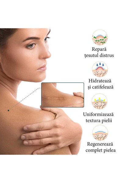 NOVA KISS Premium Reusable Medical Silicone Scar Roller, NOVA KISS®, 4 cm x 1.9 m