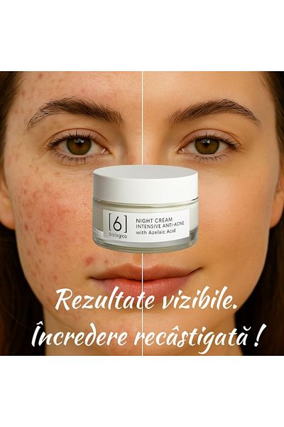 6biologico Cremă de noapte anti-acnee 100% naturală 50 ml – acid azelaic, control sebum & reparare ten