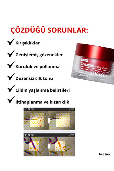 Medipeel Retinol Collagen Lifting Cream 50 ml Retinol Ve Kollajen Içeren Ikili Sıkılaştırıcı Krem M0096